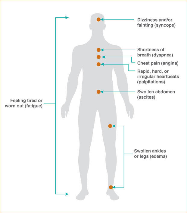 chest pain location chart